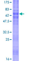 ab159588 on a 12.5% SDS-PAGE stained with Coomassie Blue.