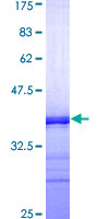 ab159589 on a 12.5% SDS-PAGE stained with Coomassie Blue.