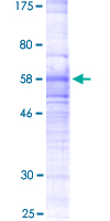12.5% SDS-PAGE analysis of ab152708 stained with Coomassie Blue.