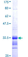 ab112356 on a 12.5% SDS-PAGE Stained with Coomassie Blue.