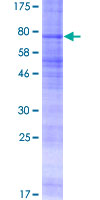 ab152709 on a 12.5% SDS-PAGE stained with Coomassie Blue.