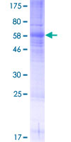 ab152710 on a 12.5% SDS-PAGE stained with Coomassie Blue.
