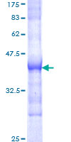 ab152698 on a 12.5% SDS-PAGE stained with Coomassie Blue.