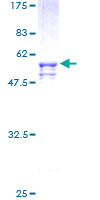 ab159561 on a 12.5% SDS-PAGE stained with Coomassie Blue.