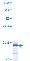ab161333 on a 12.5% SDS-PAGE stained with Coomassie Blue.