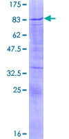 ab161275 on a 12.5% SDS-PAGE stained with Coomassie Blue.