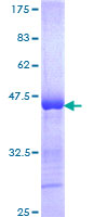 ab161276 on a 12.5% SDS-PAGE stained with Coomassie Blue.