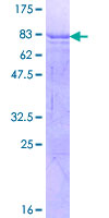 ab162316 on a 12.5% SDS-PAGE stained with Coomassie Blue.