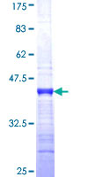 ab162317 on a 12.5% SDS-PAGE stained with Coomassie Blue.