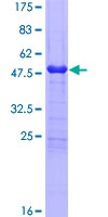 ab162682 on a 12.5% SDS-PAGE stained with Coomassie Blue.