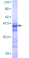 ab162683 on a 12.5% SDS-PAGE stained with Coomassie Blue.