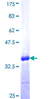 ab164256 on a 12.5% SDS-PAGE stained with Coomassie Blue.