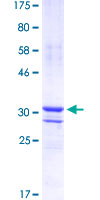 ab153589 on a 12.5% SDS-PAGE stained with Coomassie Blue.