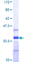 ab159564 on a 12.5% SDS-PAGE stained with Coomassie Blue.