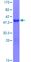 ab164038 on a 12.5% SDS-PAGE stained with Coomassie Blue.