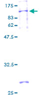 ab161923 on a 12.5% SDS-PAGE stained with Coomassie Blue.