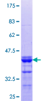 ab161924 on a 12.5% SDS-PAGE stained with Coomassie Blue.