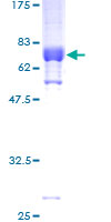 ab161790 on a 12.5% SDS-PAGE stained with Coomassie Blue.