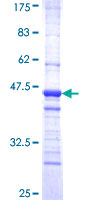 ab161791 on a 12.5% SDS-PAGE stained with Coomassie Blue.