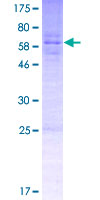 ab166002 on a 12.5% SDS-PAGE stained with Coomassie Blue.