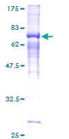 ab153523 on a 12.5% SDS-PAGE stained with Coomassie Blue.
