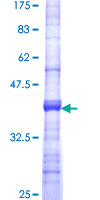 ab153326 on a 12.5% SDS-PAGE stained with Coomassie Blue.