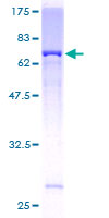 ab160708 on a 12.5% SDS-PAGE stained with Coomassie Blue.