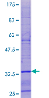 ab161087 on a 12.5% SDS-PAGE stained with Coomassie Blue.