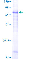 ab166087 on a 12.5% SDS-PAGE stained with Coomassie Blue.