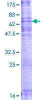 ab153615 on a 12.5% SDS-PAGE stained with Coomassie Blue.
