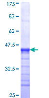 ab153616 on a 12.5% SDS-PAGE stained with Coomassie Blue.