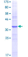 ab152932 on a 12.5% SDS-PAGE stained with Coomassie Blue.
