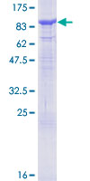 ab163404 on a 12.5% SDS-PAGE stained with Coomassie Blue.