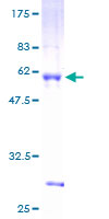 ab165176 on a 12.5% SDS-PAGE stained with Coomassie Blue.