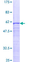ab162751 on a 12.5% SDS-PAGE stained with Coomassie Blue.
