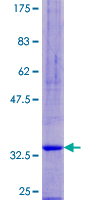 ab166515 on a 12.5% SDS-PAGE stained with Coomassie Blue.