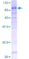 ab159822 on a 12.5% SDS-PAGE stained with Coomassie Blue.