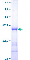 ab159823 on a 12.5% SDS-PAGE stained with Coomassie Blue.