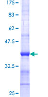 ab164680 on a 12.5% SDS-PAGE stained with Coomassie Blue.