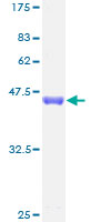 ab164199 on a 12.5% SDS-PAGE stained with Coomassie Blue.
