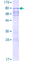 ab164627 on a 12.5% SDS-PAGE stained with Coomassie Blue.