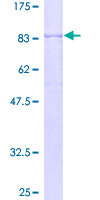 ab159575 on a 12.5% SDS-PAGE stained with Coomassie Blue.
