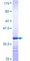 ab159500 on a 12.5% SDS-PAGE stained with Coomassie Blue.