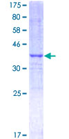 ab159961 on a 12.5% SDS-PAGE stained with Coomassie Blue.