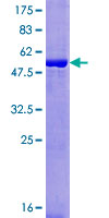 ab165402 on a 12.5% SDS-PAGE stained with Coomassie Blue.
