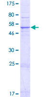 ab164060 on a 12.5% SDS-PAGE stained with Coomassie Blue.