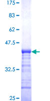 ab163577 on a 12.5% SDS-PAGE stained with Coomassie Blue.