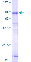 ab160020 on a 12.5% SDS-PAGE stained with Coomassie Blue.
