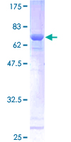 ab161727 on a 12.5% SDS-PAGE stained with Coomassie Blue.
