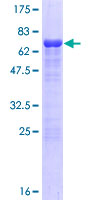 ab161735 on a 12.5% SDS-PAGE stained with Coomassie Blue.